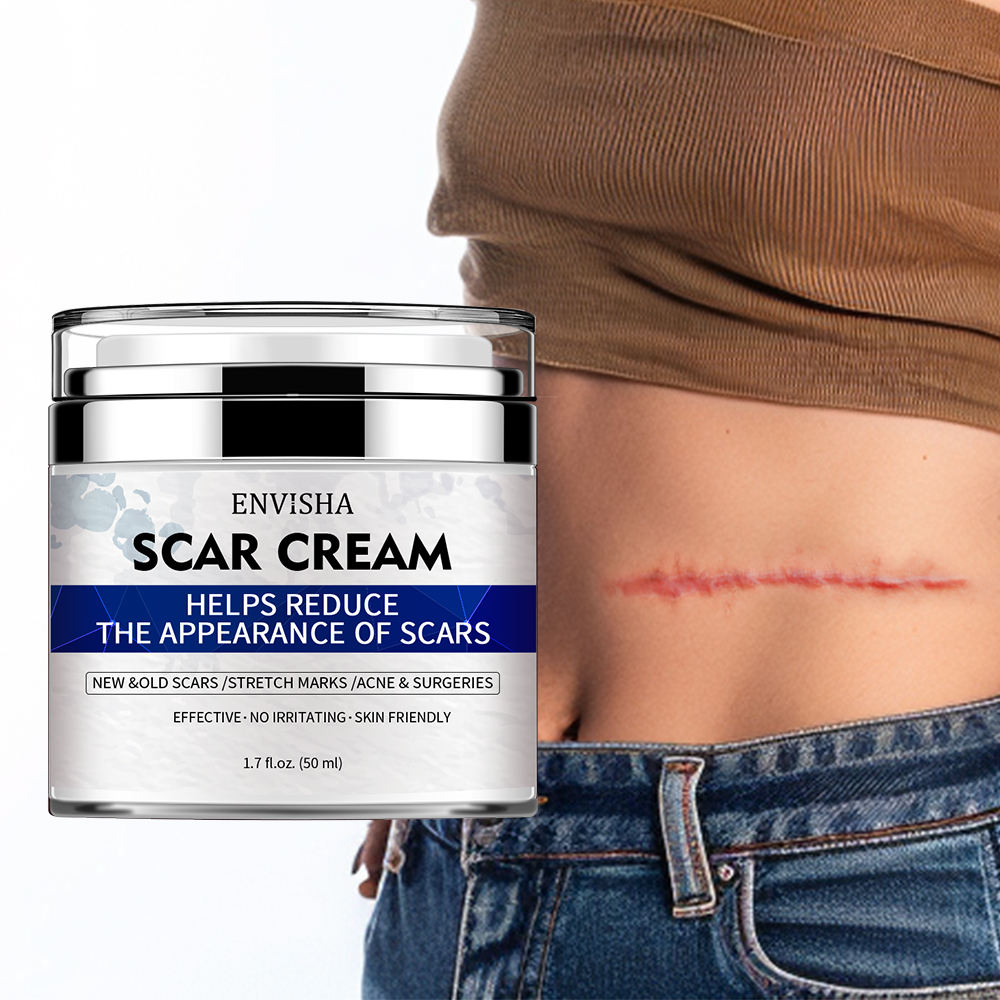 Skin Care for the Appearance of Scars, Stretch Marks & Acne Marks