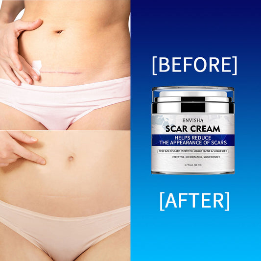 Skin Care for the Appearance of Scars, Stretch Marks & Acne Marks