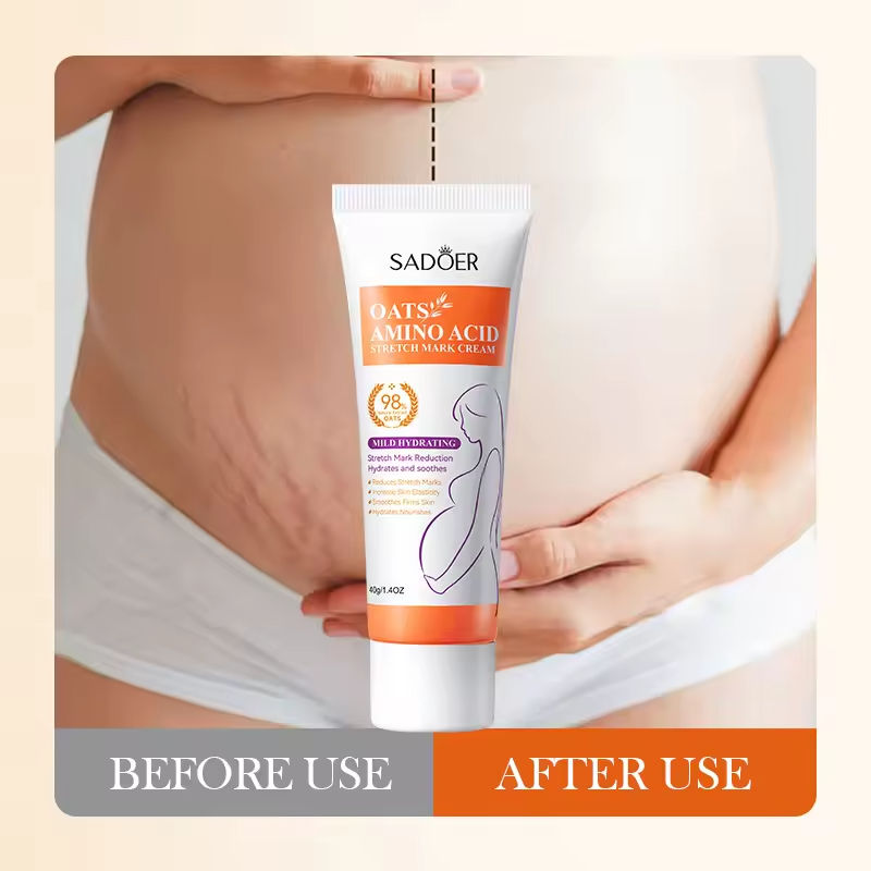 Amino Acid Stretch Mark Cream – Hydrating Skin Care