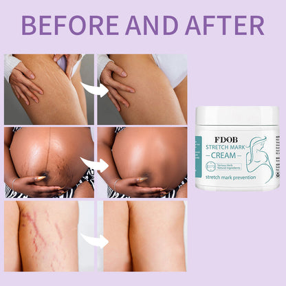Stretch Mark Cream with Natural Ingredients